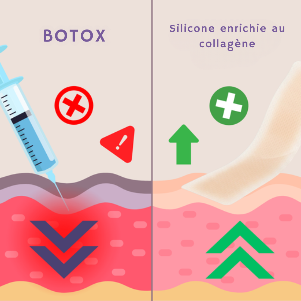 Le Botox est littéralement un poison